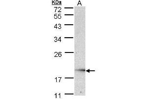 WB Image Sample (30 ug of whole cell lysate) A: Raji , 12% SDS PAGE antibody diluted at 1:1000 (UBE2G2 Antikörper)
