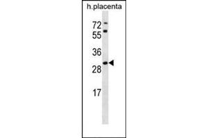 Western blot analysis in human placenta tissue lysates (35ug/lane) using STARD4 Antibody (N-term) Cat. (STARD4 Antikörper  (N-Term))