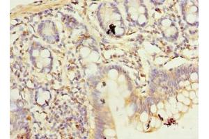 Immunohistochemistry of paraffin-embedded human small intestine tissue using ABIN7174699 at dilution of 1:100 (AKNA Domain Containing 1 (AKNAD1) (AA 1-223) Antikörper)