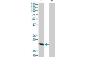Western Blot analysis of CABP4 expression in transfected 293T cell line by CABP4 monoclonal antibody (M02), clone 5G11. (CABP4 Antikörper  (AA 1-170))