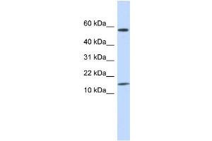 WB Suggested Anti-KRTAP11-1 Antibody Titration:  0. (KRTAP11-1 Antikörper  (N-Term))