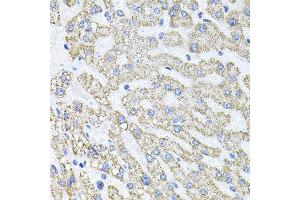Immunohistochemistry of paraffin-embedded human liver injury using SDC2 antibody at dilution of 1:100 (x40 lens). (Syndecan 2 Antikörper)