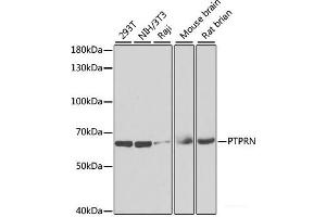 Western blot analysis of extracts of various cell lines using PTPRN Polyclonal Antibody at dilution of 1:1000. (PTPRN Antikörper)