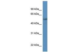 Image no. 1 for anti-Transcriptional Adaptor 2A (TADA2A) (AA 338-387) antibody (ABIN6746060) (TADA2L Antikörper  (AA 338-387))
