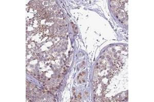 Immunohistochemical staining of human testis with C14orf1 polyclonal antibody  shows distinct staining in spermatids. (C14orf1 Antikörper)