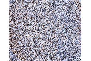 IHC analysis of SP1 using anti-SP1 antibody (ABIN7601559). (SP1 Antikörper  (AA 384-603))