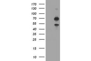 Image no. 2 for anti-tRNA Methyltransferase 2 Homolog A (TRMT2A) antibody (ABIN1501520) (TRMT2A Antikörper)