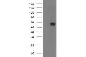 Western Blotting (WB) image for anti-SET Domain Containing (Lysine Methyltransferase) 7 (SETD7) antibody (ABIN1500904) (SETD7 Antikörper)