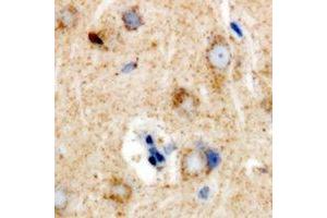 Immunohistochemical analysis of Ribophorin-2 staining in rat brain formalin fixed paraffin embedded tissue section. (Ribophorin II Antikörper)