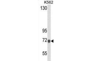 Western Blotting (WB) image for anti-Lactotransferrin (LTF) antibody (ABIN2995307)