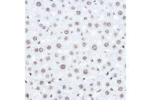 Immunohistochemistry of paraffin-embedded rat liver using SETD5 Rabbit pAb (ABIN6132960, ABIN6147644, ABIN6147646 and ABIN6223140) at dilution of 1:100 (40x lens). (SETD5 Antikörper  (AA 520-740))