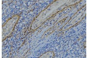 ABIN6274996 at 1/100 staining Human uterus tissue by IHC-P. (CBLN4 Antikörper  (Internal Region))