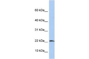WB Suggested Anti-IL1B Antibody Titration: 0. (IL-1 beta Antikörper  (N-Term))
