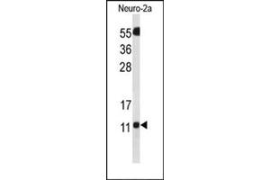 Western blot analysis of SH3BGRL3 Antibody (Center) Cat.