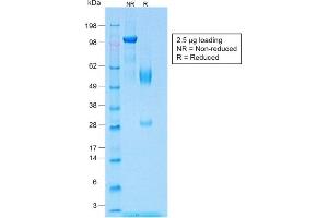 SDS-PAGE Analysis of Purified Wilm's Tumor Rabbit Recombinant Monoclonal Antibody (WT1/1434R). (Rekombinanter WT1 Antikörper)