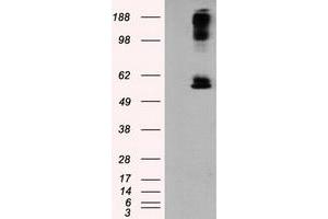 HEK293T cells were transfected with the pCMV6-ENTRY control (Left lane) or pCMV6-ENTRY LIPG (Right lane) cDNA for 48 hrs and lysed. (LIPG Antikörper)
