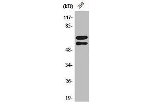 Western Blot analysis of 293 cells using Phospho-Lyn (Y508) Polyclonal Antibody (LYN Antikörper  (pTyr508))