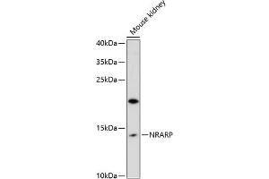 Western blot analysis of extracts of mouse kidney, using NRARP antibody (ABIN6133041, ABIN6144838, ABIN6144839 and ABIN6216665) at 1:3000 dilution.