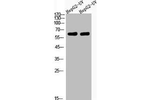 Western Blot analysis of HepG2-UV cells using Acetyl-Cortactin (K235) Polyclonal Antibody (Cortactin Antikörper  (acLys235))
