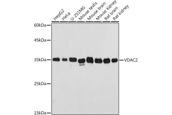 VDAC2 Antikörper  (AA 1-100)