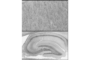 Adult rat cerebral cortex and hippocampus immunohistochemistry with antigen retrieval via pepsin pretreatment.