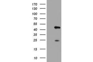 Western Blotting (WB) image for anti-Centromere Protein H (CENPH) antibody (ABIN1497474) (CENPH Antikörper)