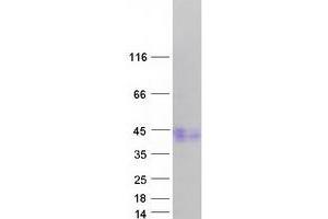 Western Blotting (WB) image for Activin Receptor Type 1C (ACVR1C) (Transcript Variant 4) protein (Myc-DYKDDDDK Tag) (ABIN2714365)