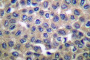 Image no. 1 for anti-Heat Shock Protein 90kDa beta (Grp94), Member 1 (HSP90B1) antibody (ABIN265448)