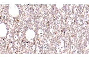 Immunohistochemistry (IHC) image for anti-Aspartate beta-Hydroxylase (ASPH) (AA 345-758) antibody (ABIN7427174)