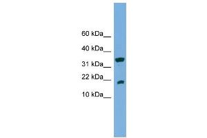 WB Suggested Anti-ACP1  Antibody Titration: 0. (ACP1 Antikörper  (Middle Region))