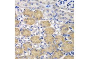 Immunohistochemistry of paraffin-embedded mouse kidney using SND1 antibody at dilution of 1:100 (40x lens). (SND1 Antikörper)