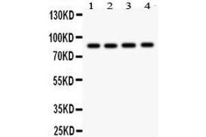 Western Blotting (WB) image for anti-NADPH Oxidase 5 (NOX5) (AA 747-765), (C-Term) antibody (ABIN3042984)