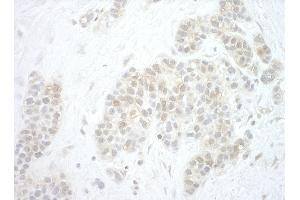 anti-Pygopus Homolog 2 (PYGO2) (AA 356-406) antibody