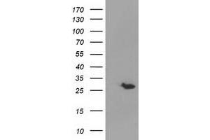 Western Blotting (WB) image for anti-Glutathione S-Transferase theta 2 (GSTT2) antibody (ABIN1498554)