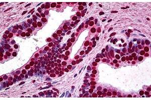 Human Prostate: Formalin-Fixed, Paraffin-Embedded (FFPE) (MEF2A Antikörper  (AA 71-170))