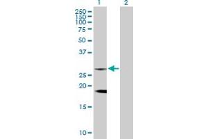 Western Blot analysis of CLTB expression in transfected 293T cell line by CLTB MaxPab rabbit polyclonal antibody. (CLTB Antikörper  (AA 1-211))