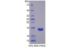 SDS-PAGE analysis of Pig FABP2 Protein.