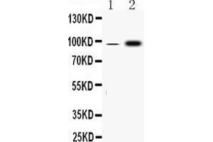 Western blot analysis of FGA expression in rat skeletal muscle extract ( Lane 1) and HEPG2 whole cell lysates ( Lane 2).