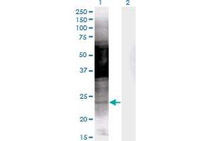 Western Blot analysis of PRKCDBP expression in transfected 293T cell line by PRKCDBP monoclonal antibody (M04), clone 8D3. (PRKCDBP Antikörper  (AA 161-261))