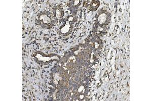 IHC analysis of REA/PHB2 using anti REA/PHB2 antibody (ABIN7599240). (Prohibitin 2 Antikörper  (AA 1-299))