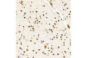 Immunohistochemistry of paraffin embedded mouse cerebellum using USP27 (ABIN7076113) at dilution of 1:700 (400x lens) (USP27X Antikörper)