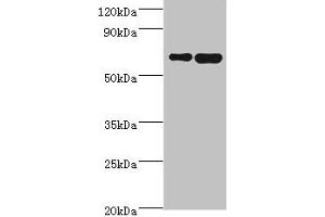 Western blot All lanes: STXBP3 antibody at 10 μg/mL Lane 1: HepG2 whole cell lysate Lane 2: K562 whole cell lysate Secondary Goat polyclonal to rabbit IgG at 1/10000 dilution Predicted band size: 68 kDa Observed band size: 68 kDa (STXBP3 Antikörper  (AA 343-592))