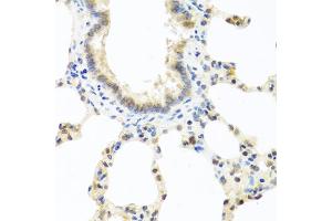 Immunohistochemistry of paraffin-embedded rat lung using DEDD antibody (ABIN5973422) at dilution of 1/100 (40x lens). (DEDD Antikörper)
