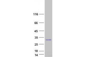 Validation with Western Blot (m1ip1 Protein (Transcript Variant 1) (Myc-DYKDDDDK Tag))