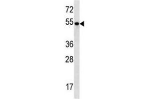TBC1D3E antibody western blot analysis in NCI-H292 lysate (TBC1D3E (AA 498-527) Antikörper)