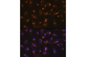 anti-RAB11A, Member RAS Oncogene Family (RAB11A) antibody