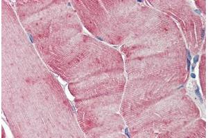 Human Skeletal Muscle: Formalin-Fixed, Paraffin-Embedded (FFPE) (Aurora A Antikörper)