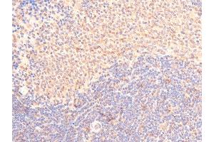 ABIN6267289 at 1/100 staining rat spleen cancer tissue sections by IHC-P. (p53 Antikörper  (pSer15))