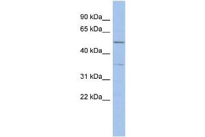 WB Suggested Anti-ABHD15 Antibody Titration: 0. (ABHD15 Antikörper  (Middle Region))