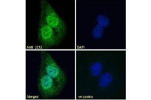 (ABIN185018) Immunofluorescence analysis of paraformaldehyde fixed U2OS cells, permeabilized with 0. (ECT2 Antikörper  (N-Term))